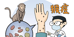 预防猴痘病毒 可从三方面入手